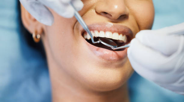 Best Emergency Dentist for Knocked-Out Tooth in Morris, AL